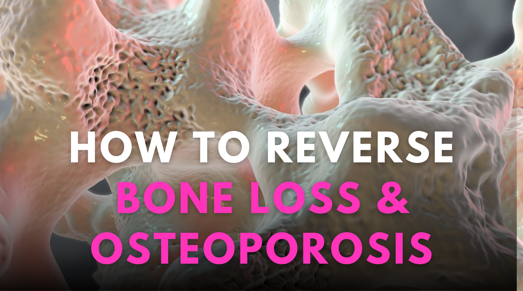 Understanding osteoporosis and the benefits of plant-based calcium